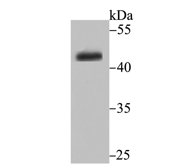 Anti-CYP26A1 Antibody (8F696)