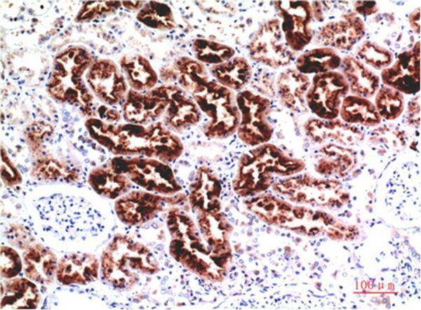 Anti-CST3 Antibody (1A172)