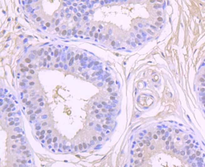 Anti-CSNK2B Antibody (8H798)