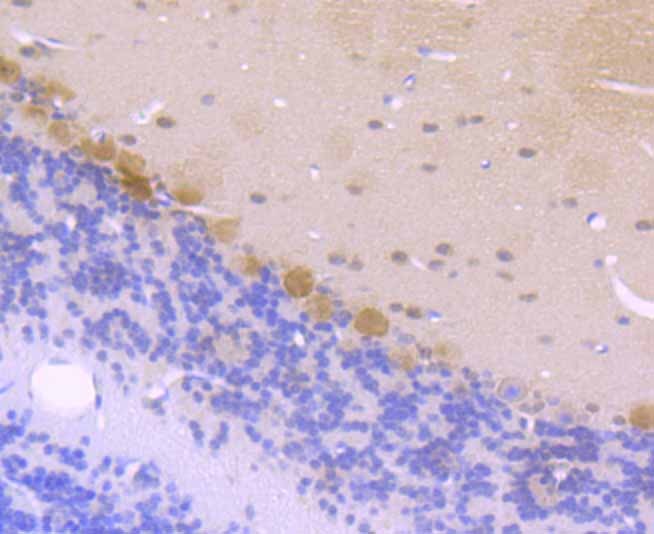 Anti-CSNK2B Antibody (8H798)
