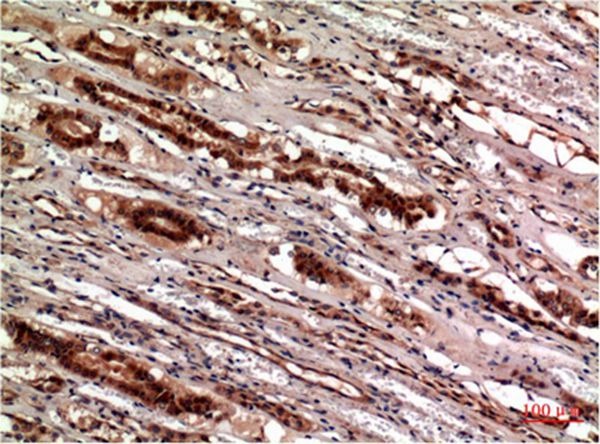 Anti-CST3 Antibody (4F224)