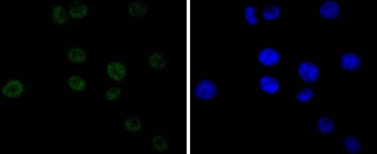 Anti-CDK9 Antibody (1M957)
