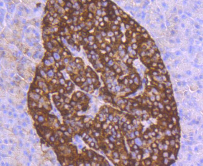 Anti-CHGA Antibody (9D68)
