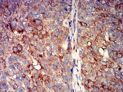 Anti-CHRNA7 Antibody (5X667)
