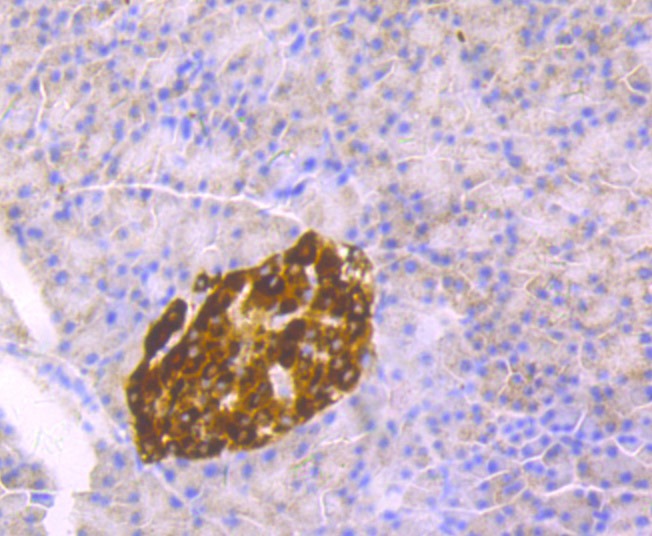 Anti-CHGA Antibody (5H899)