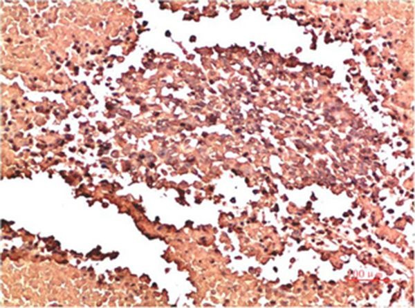 Anti-Collagen II/COL2A1 Antibody (6L401)
