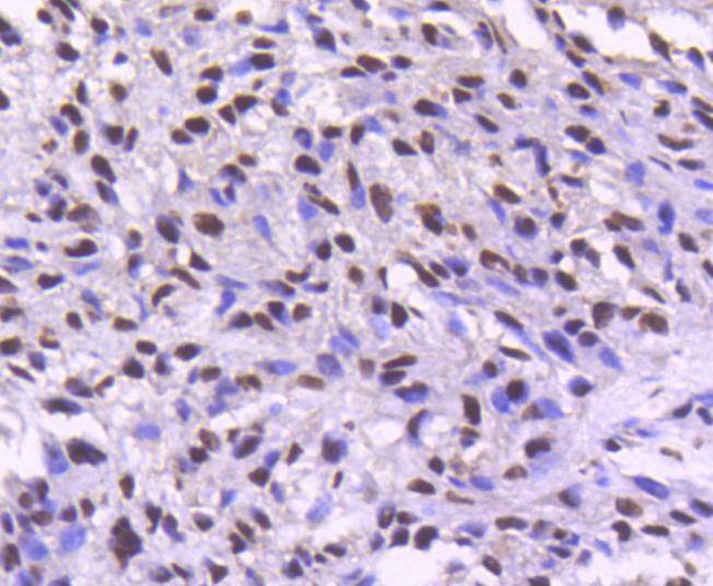 Anti-CDK9 Antibody (1M957)