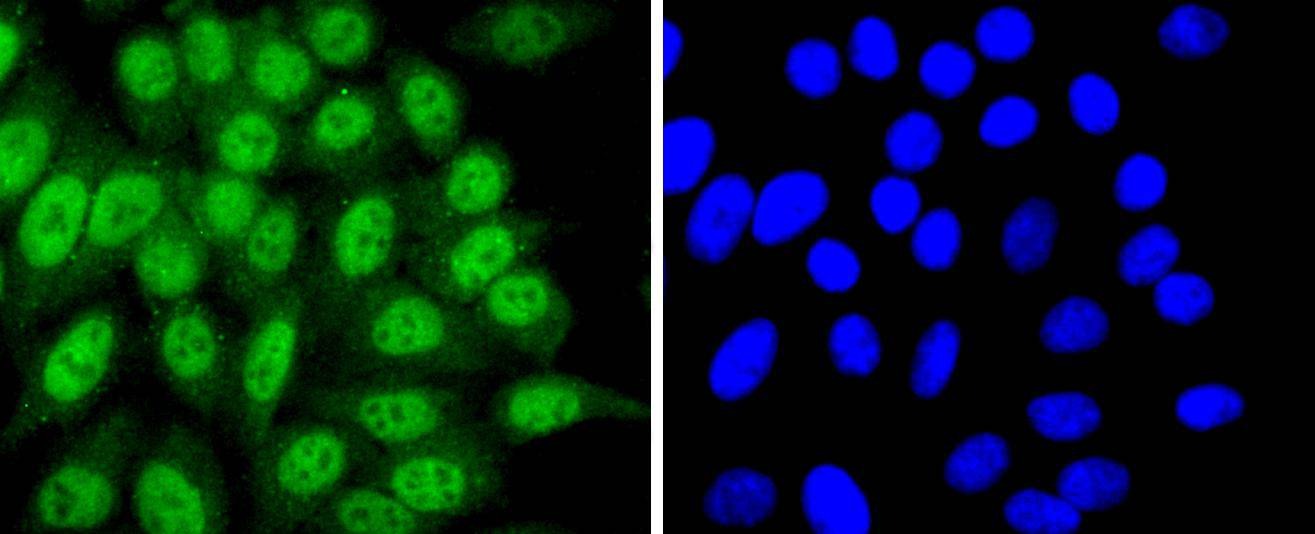 Anti-CDK7 Antibody (3Y405)