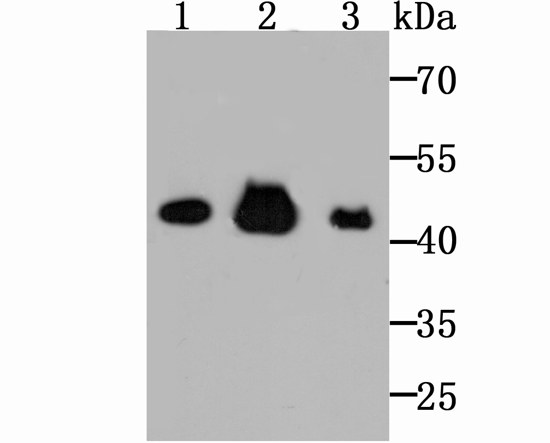 Anti-Citrate Synthase Antibody (7Y580)