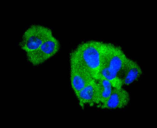 Anti-COL6A3 Antibody (4A311)