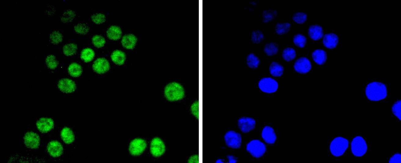 Anti-CDK9 Antibody (1M957)