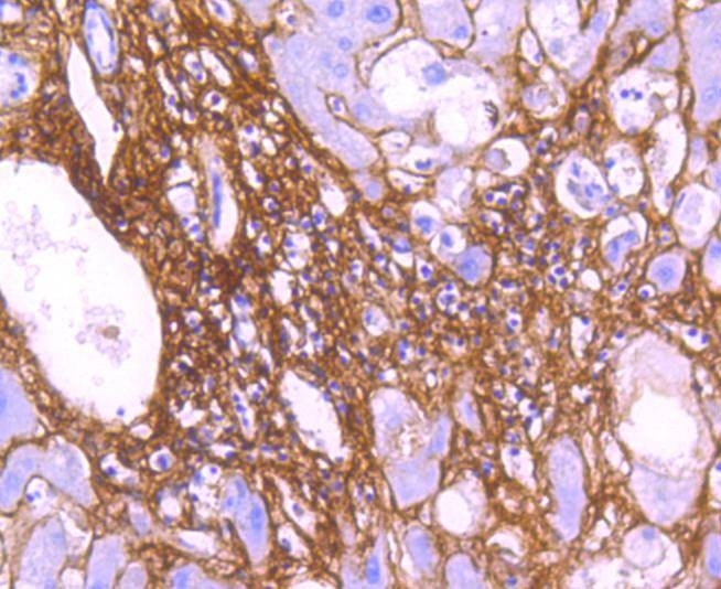 Anti-COL6A3 Antibody (4A311)