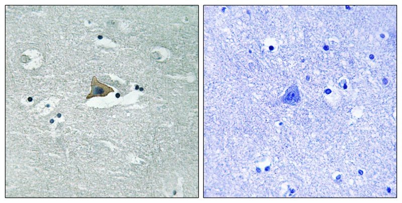 Anti-Phospho-Claudin-5 (Tyr217) Polyclonal Antibody