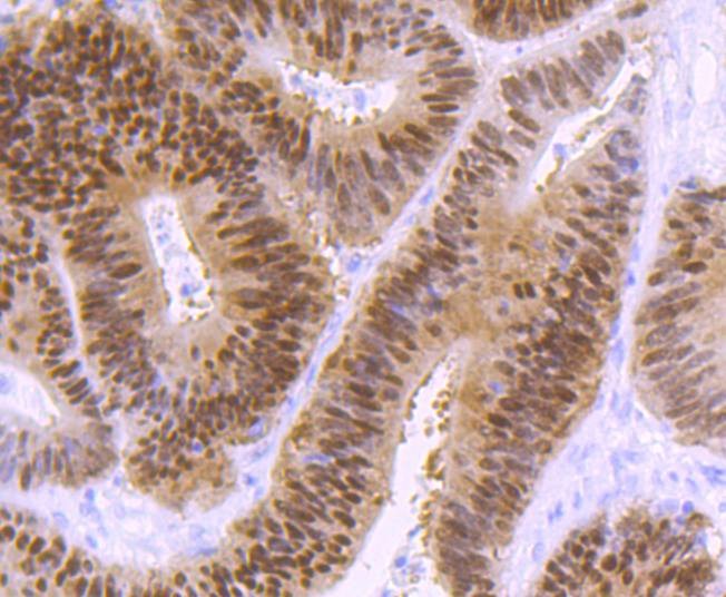Anti-CDX2 Antibody (1N738)