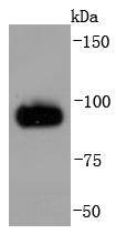 Anti-CHGA Antibody (9D68)