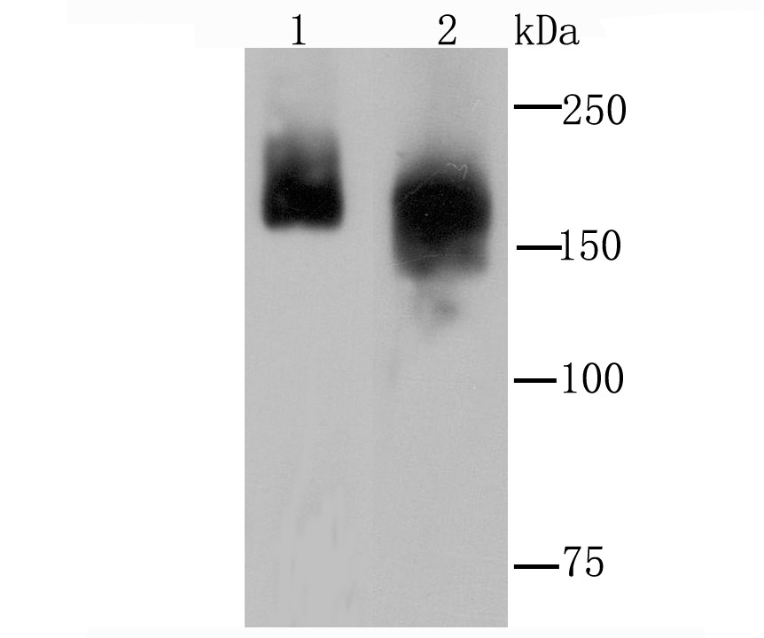 Anti-CLTCL1 Antibody (5B160)