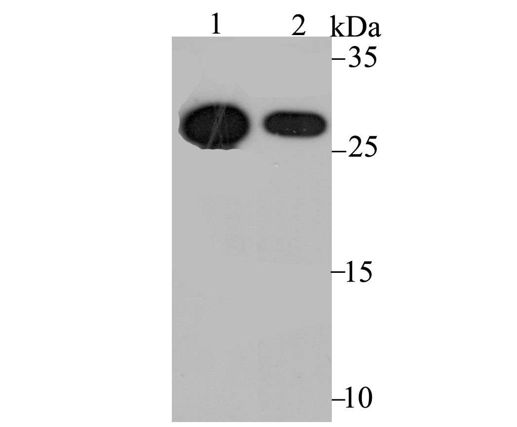Anti-CDX1 Antibody (5H993)