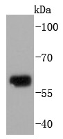 Anti-Collagen X Antibody (6O453)