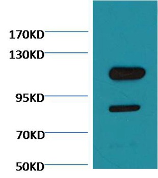 Anti-Cleaved PARP Antibody (7Y437)