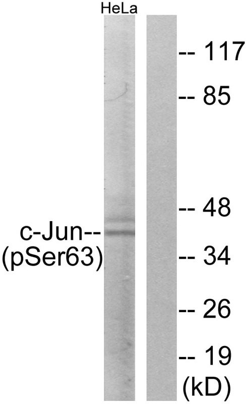 Anti-Phospho-JUN (Ser63) Polyclonal Antibody