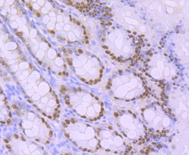 Anti-CDX2 Antibody (1N738)