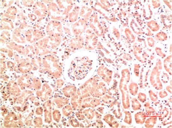 Anti-COL4A1 Antibody (8T317)
