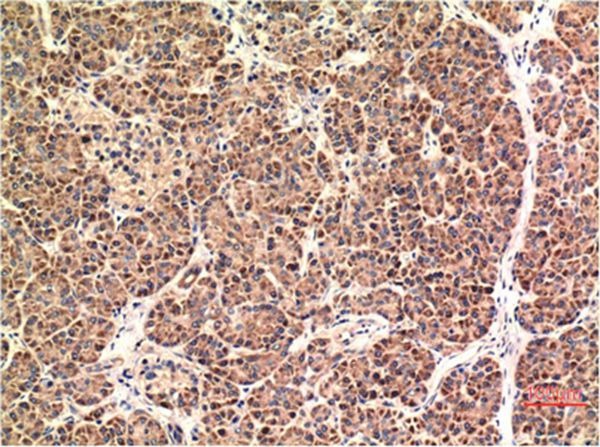 Anti-DDIT3 Antibody (6D234)