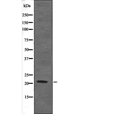 Anti-Phospho-Claudin-4 (Tyr208) Polyclonal Antibody