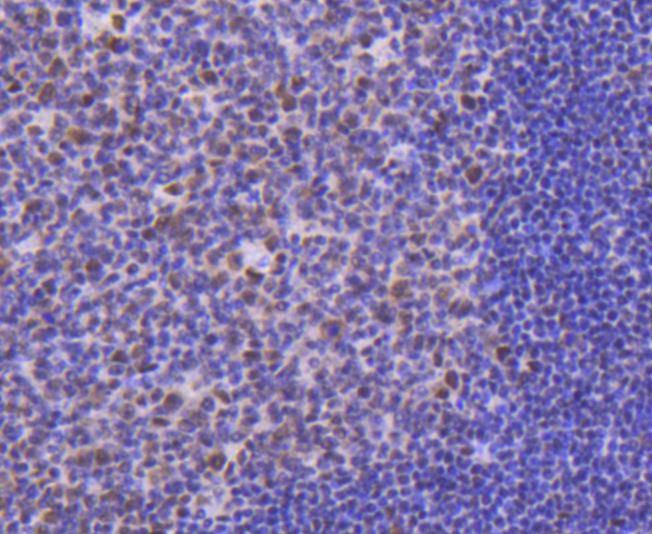 Anti-CDK9 Antibody (1M957)