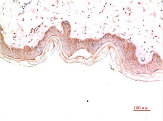 Anti-COL4A1 Antibody (8T317)