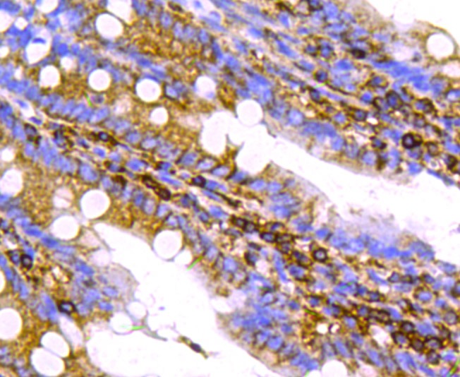 Anti-CHGA Antibody (5H899)