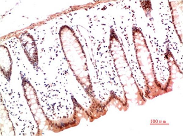 Anti-Collagen I Antibody (1T56)