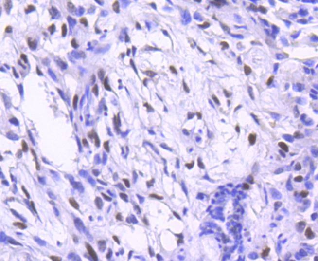 Anti-JUN Antibody (7A403)