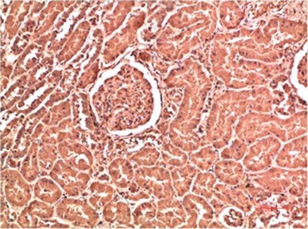 Anti-COL4A1 Antibody (9O530)