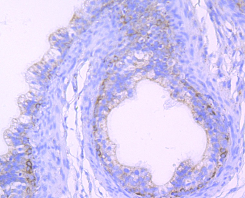 Anti-Citrate Synthase Antibody (7Y580)
