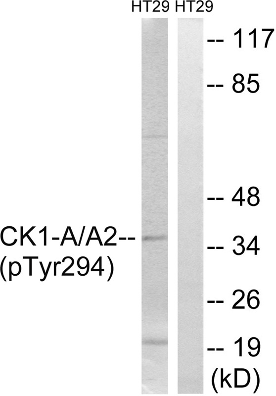 Anti-Phospho-CK1 alpha (Tyr294) Polyclonal Antibody