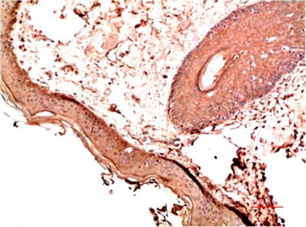Anti-Collagen I Antibody (1G115)