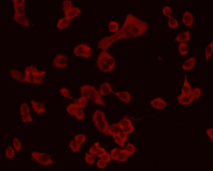 Anti-CHGA Antibody (5H899)