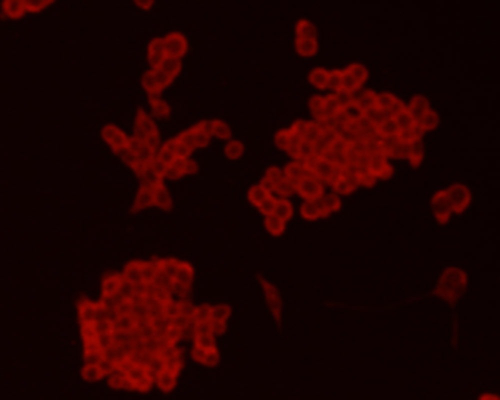 Anti-CHGA Antibody (5H899)