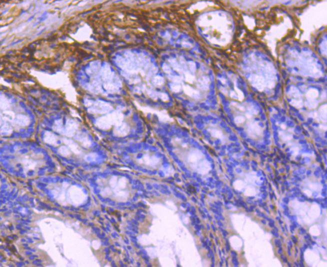 Anti-COL6A3 Antibody (4A311)