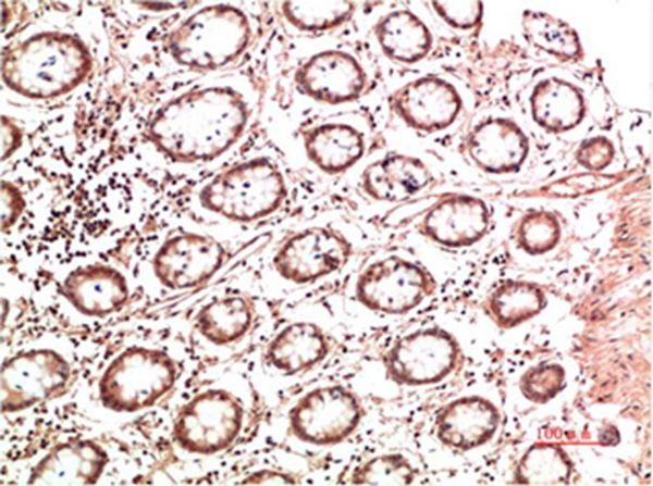 Anti-Collagen II/COL2A1 Antibody (1R829)