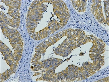 Anti-KRT8 Antibody (6W904)