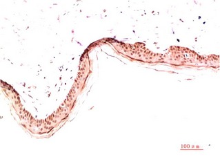 Anti-Collagen I Antibody (7S639)