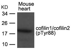 Anti-Phospho-Cofilin (Tyr88) Polyclonal Antibody