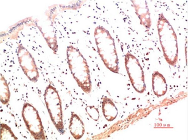 Anti-Collagen I Antibody (9B269)