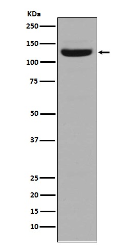 Anti-Collagen I Antibody (7K155)