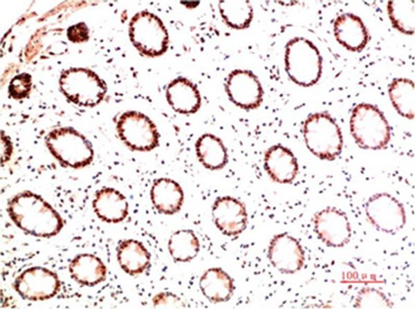 Anti-Collagen I Antibody (7S639)