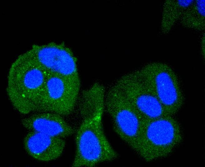 Anti-CHEK1 Antibody (6N369)
