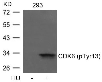 Anti-Phospho-CDK6 (Tyr13) Polyclonal Antibody