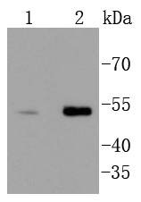 Anti-CHEK1 Antibody (6N369)